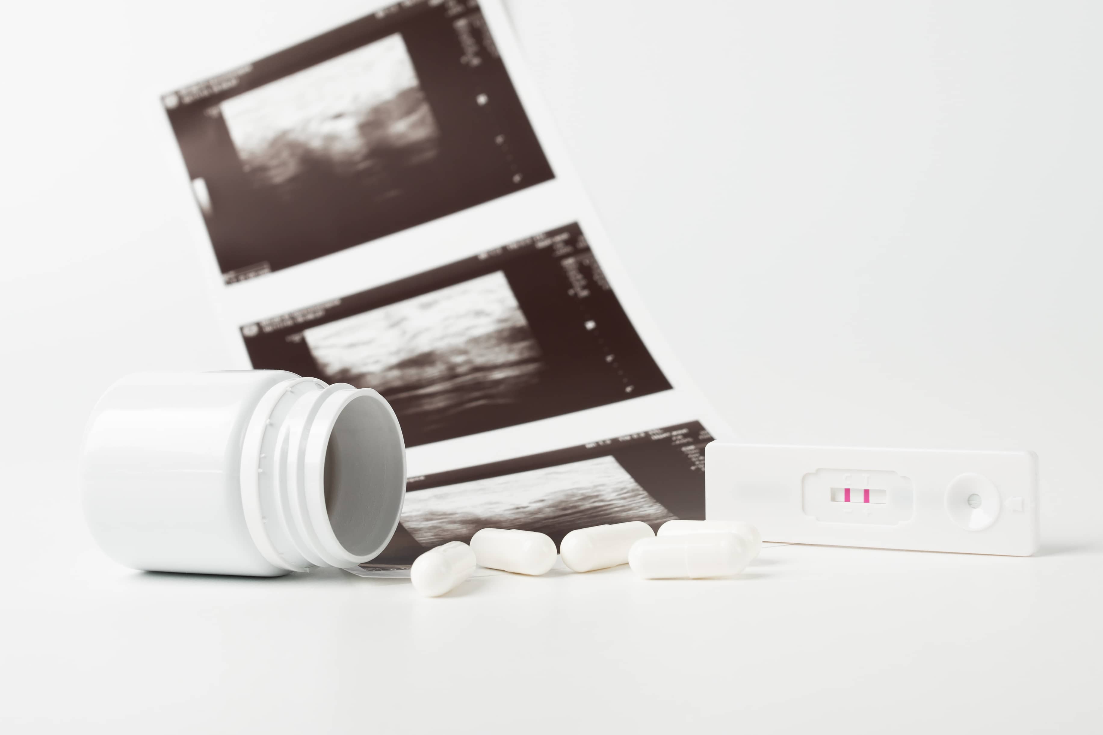 abortion-pill-ultrasound